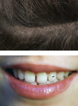 Dermo Styl - Pigmentation cuir chevelu, bijoux dentaires
